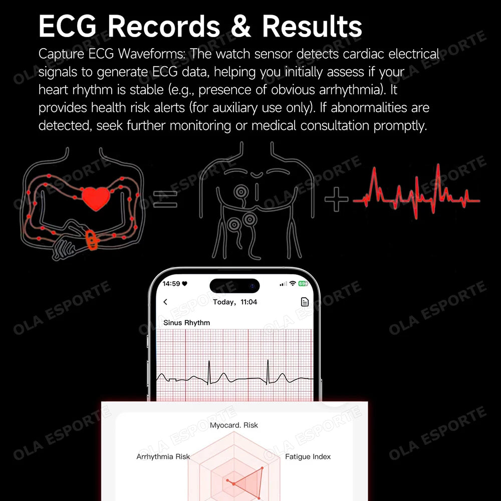 2026 NO Screen Smart Bracelet ECG+PPG SOS Heart Rate Blood Pressure Stress Temperature Sports Waterproof Screenless Smartwatch